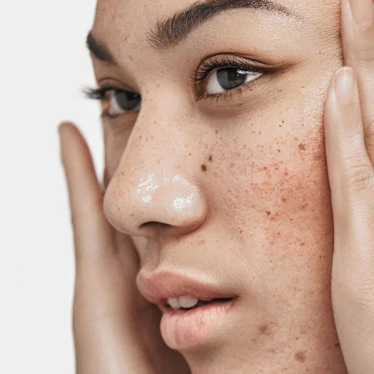 The Routine for Skin That's Been Through It