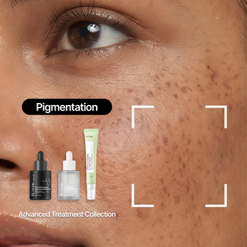 <strong>Three: Skin That's Showing the Marks</strong>