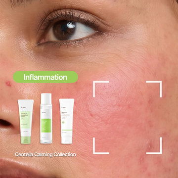 <strong>One: Skin That's Turned Reactive</strong>